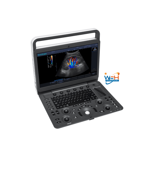e2-sonoscape-ultrasound-scanner